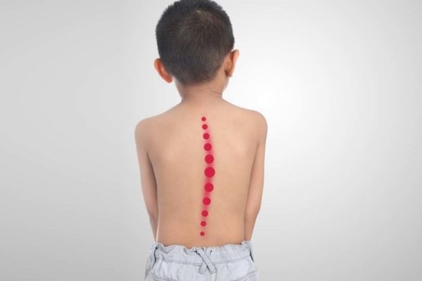 7 Cara Efektif Mendukung Kesehatan Sendi Anak Sejak Dini