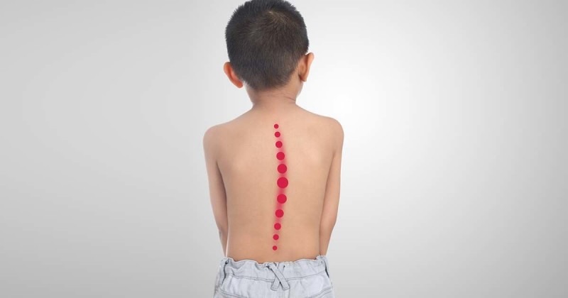 7 Cara Efektif Mendukung Kesehatan Sendi Anak Sejak Dini