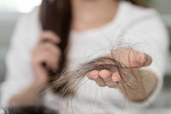 10 Tips Mengatasi Masalah Rambut Rontok dan Menipis