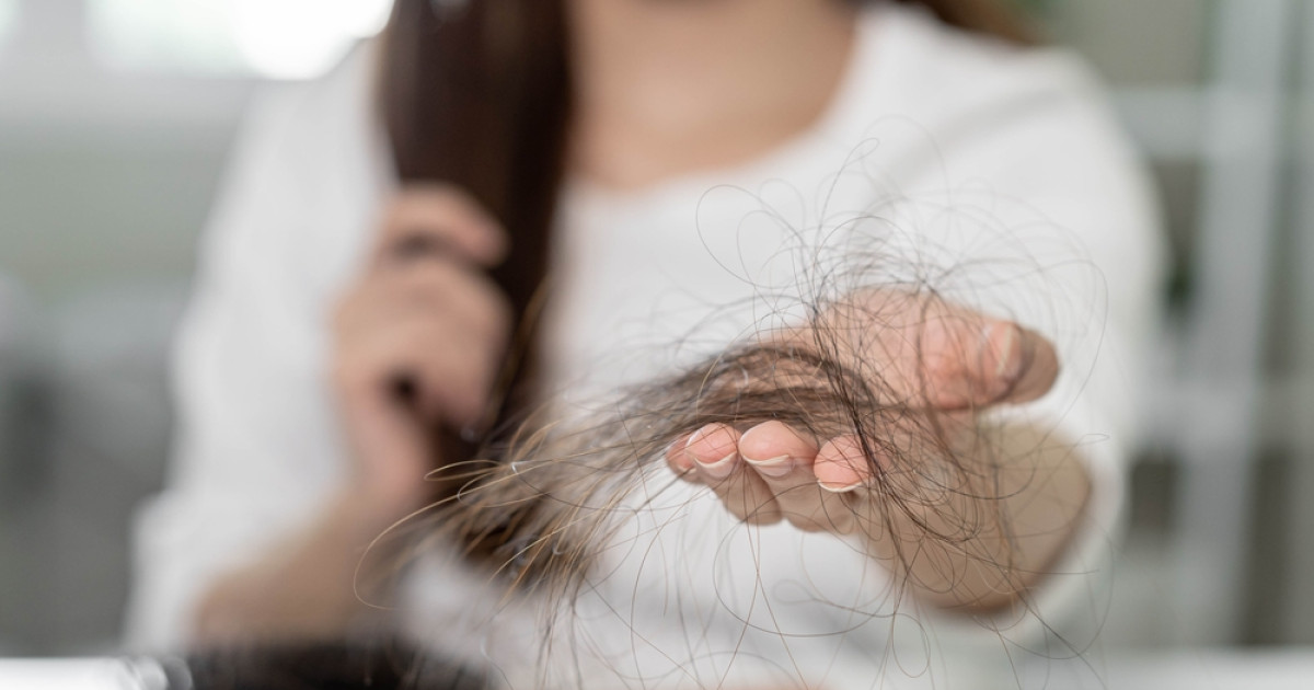 10 Tips Mengatasi Masalah Rambut Rontok dan Menipis