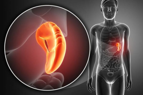 10 Cara Meningkatkan Fungsi Limpa Tanpa Obat 10 Cara Meningkatkan Fungsi Limpa Tanpa Obat