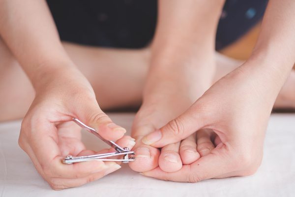 5 Tips Menghindari Kuku Tumbuh ke Dalam