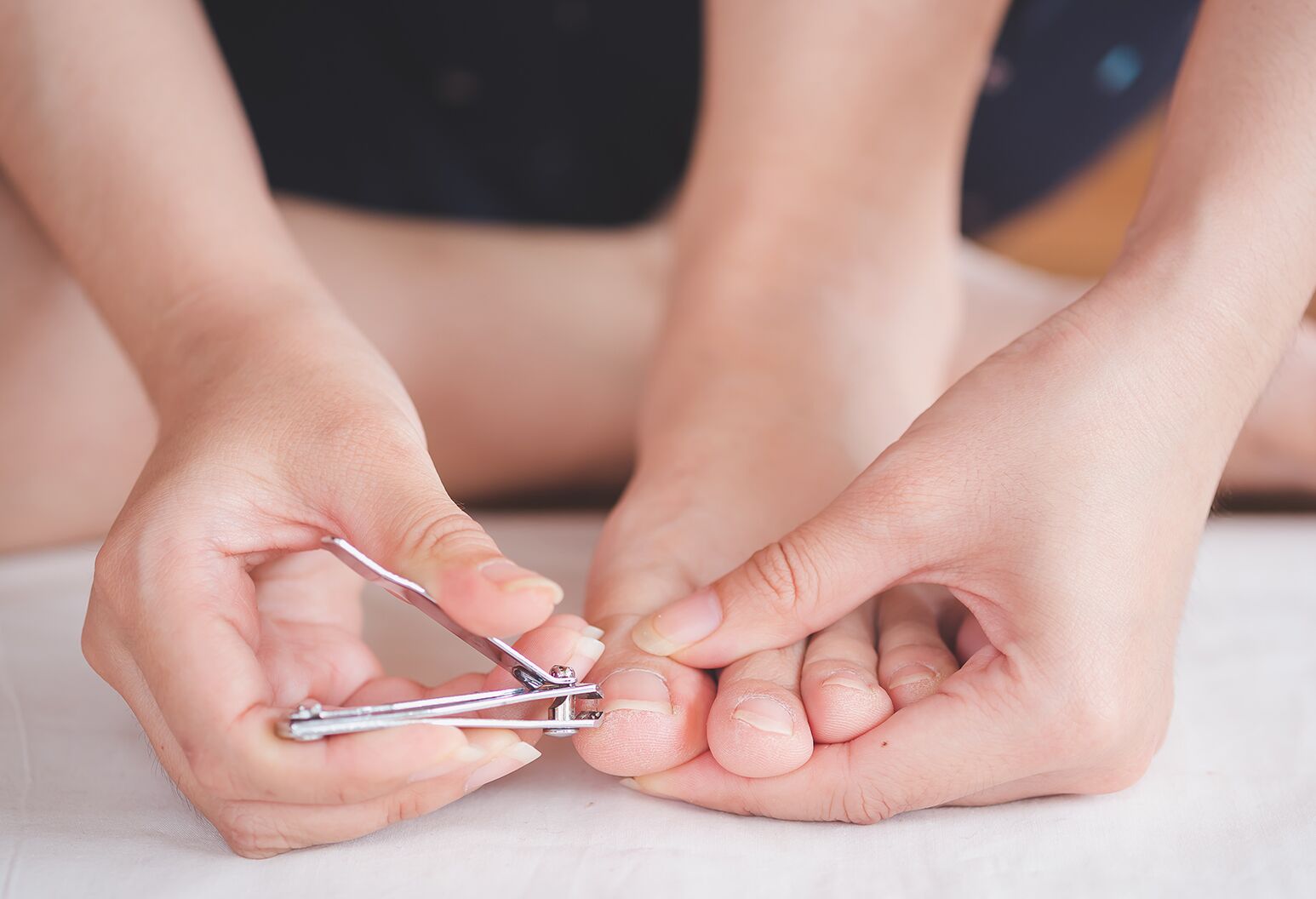 5 Tips Menghindari Kuku Tumbuh ke Dalam