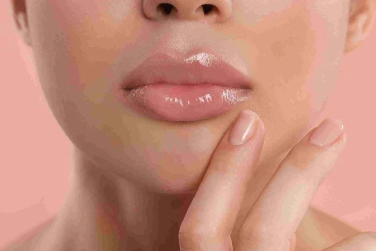 5 Cara Cepat Sembuhkan Bibir Luka atau Tergores