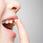 10 Tips Mengatasi Gigi Copot pada Orang Dewasa